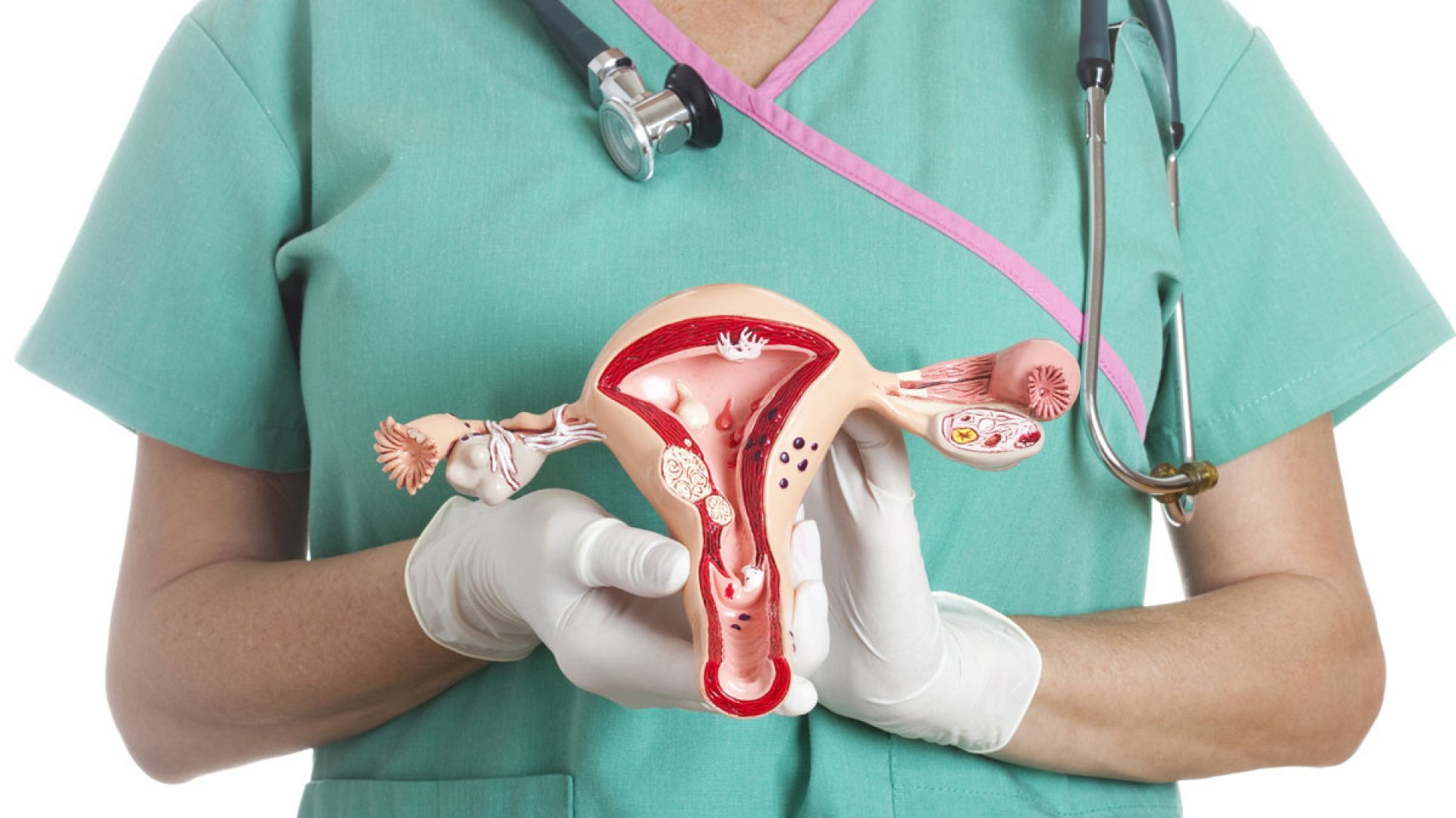 Sarcoma uterino esperanza de vida